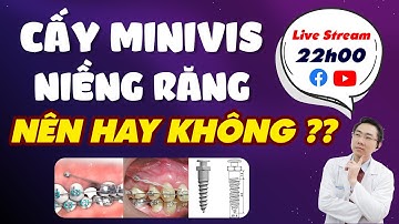 Tại Sao Phải Cắm Minivis Khi Niềng Răng | Có Thực Sự Đáng Sợ?