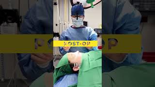 Nose Job Transformation - From Crooked to Perfect ✅