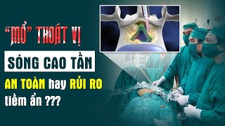 Chữa Thoát Vị Đĩa Đệm Bằng Sóng Cao Tần Không Mất Máu. Bác Sĩ Tiết Lộ Cách Điều Trị Thoát Vị An Toàn