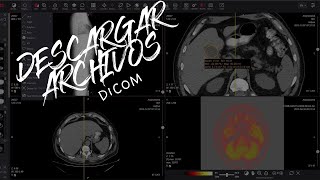 How to Download DICOM Files from the System