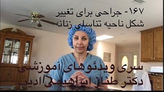 ۱۶۷- جراحی به منظور تغییر شکل ناحیه تناسلی خارجی