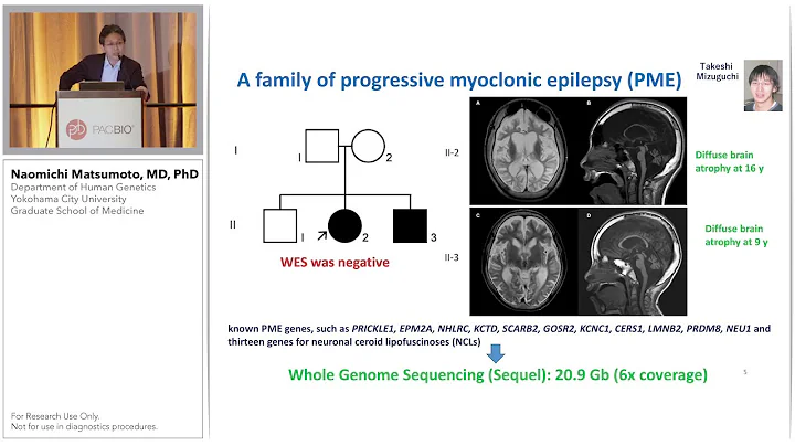 Long-read Sequencing for Disease Genome Analysis: Our Experiences