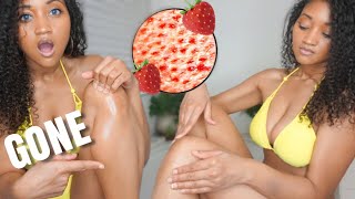 How To Get Rid Of Strawberry Legs with PROOF! Before and After footage