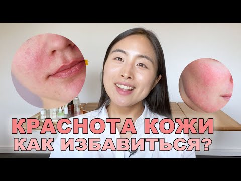 Как Избавиться От Красноты Кожи Несколько Лайфхаков