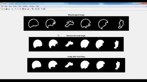 ABO Blood Group Detection matlab projects | ABO Blood Group Detection matlab thesis