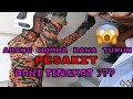 | KHIDMAT KHAS MENGANGKAT PESAKIT | TERBAIK ABANG BOMBA KITA ANGKAT MANGSA DARI TINGKAT 7 TU..