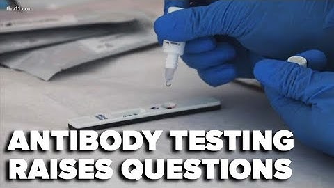 Questions raised over COVID-19 antibody testing results