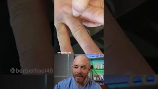 Fascinating Hair Splinter Removal