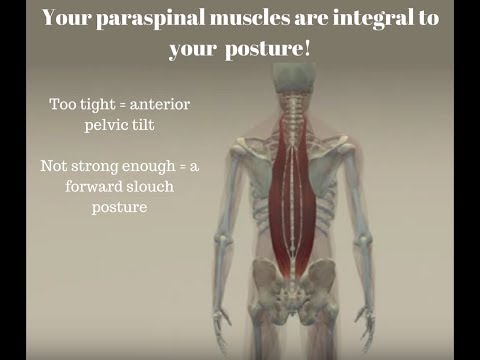 How your paraspinal muscles impact your posture