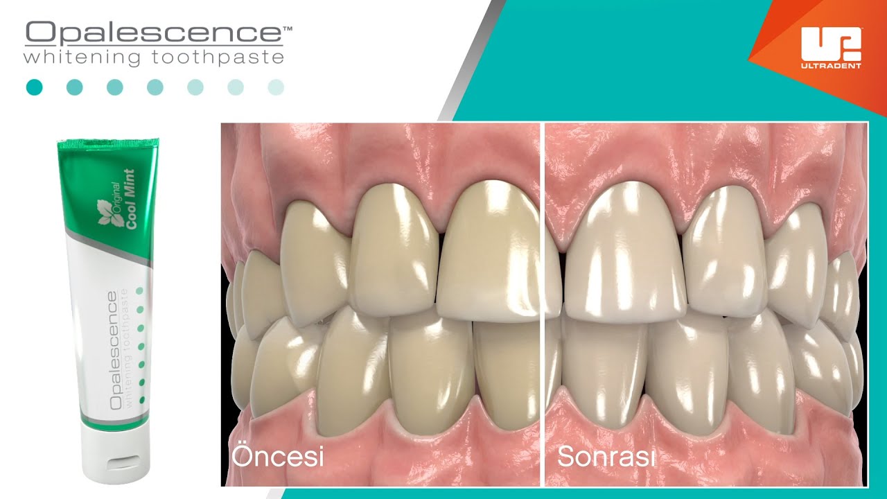 Opalescence™ Beyazlatıcı Diş Macunu Nasıl Çalışır? - YouTube