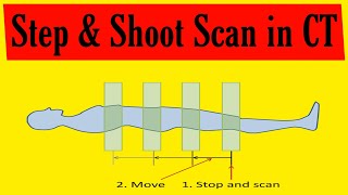 Step and Shoot Method in CT | CT Scanning Modes | Basics of CT