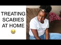 How to treat scabies at home  dnvlogslife