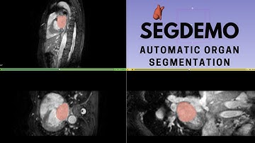 Automatic organ segmentation by Psychosensing Lab PSNC
