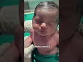 New born baby in NICU #scalpvein #hospital #internationallyeducatednurse #medicaltraining #nurse