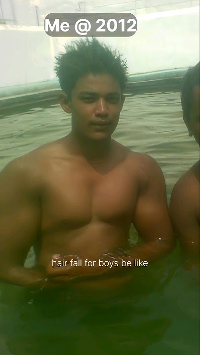 hair-fall-for-boys-13yr-transformation-shorts-viral-youtube