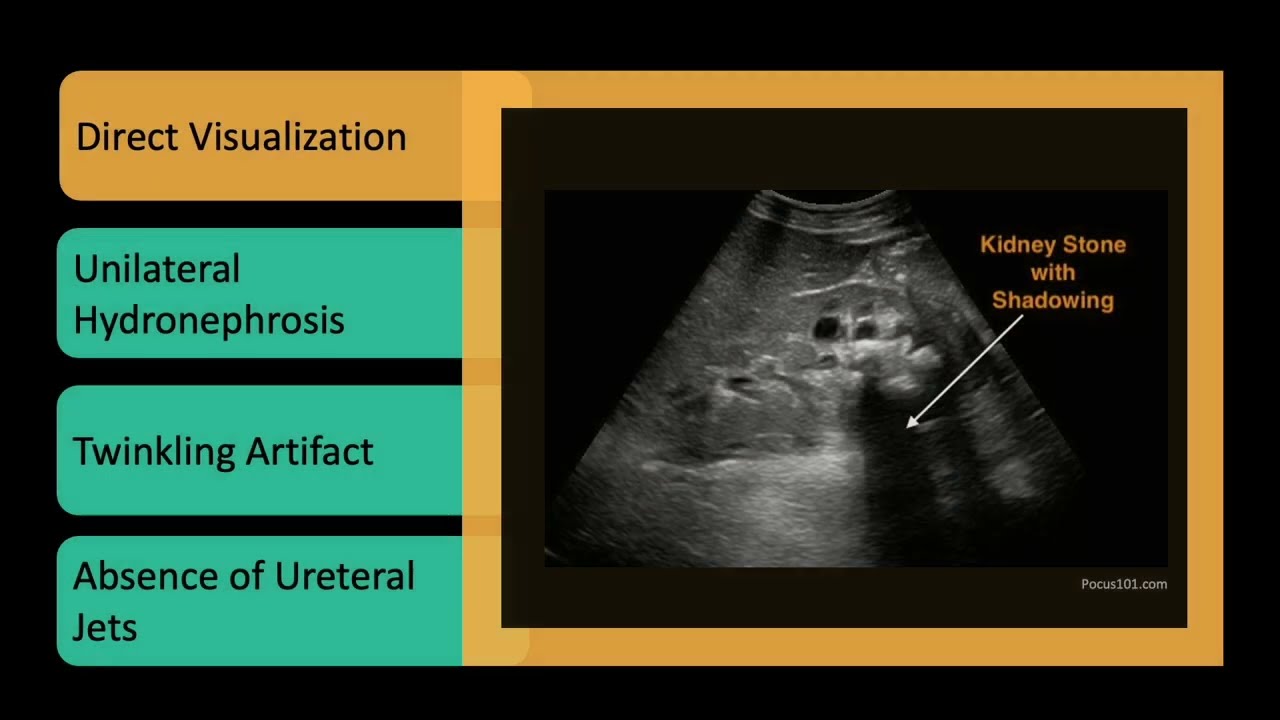 POCUS for Kidneys & Bladder | Hydronephrosis, Stones & Urinary Retention Made Simple