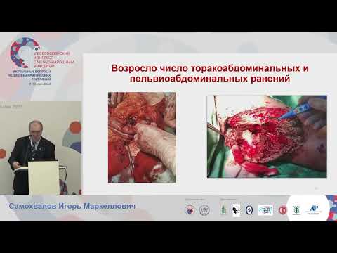 Огнестрельная травма Самохвалов И.М.