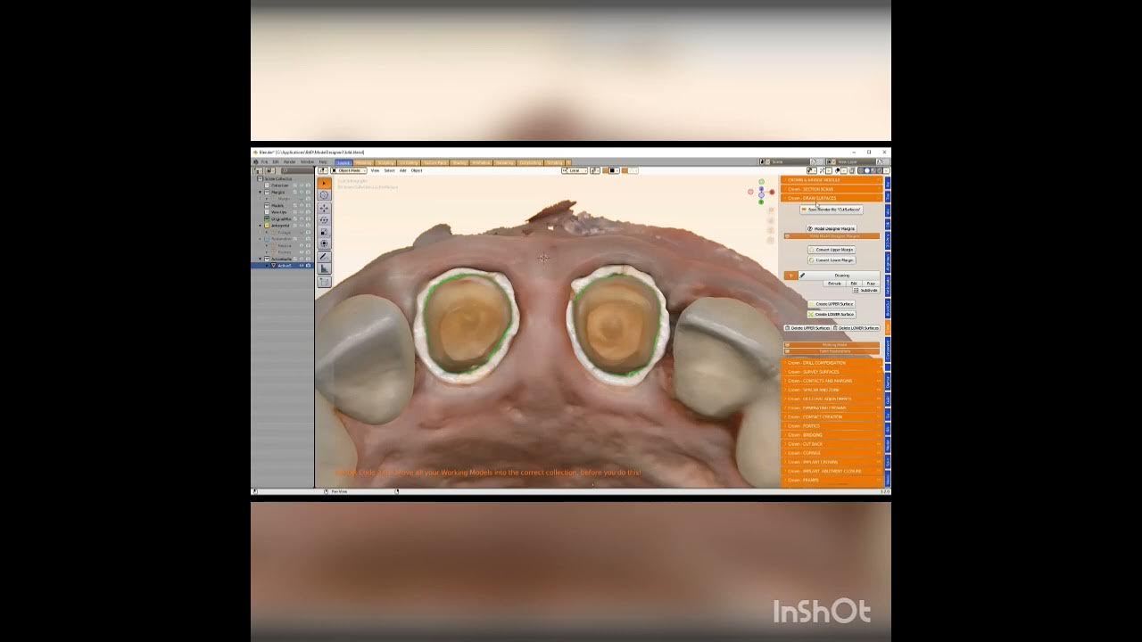 blender for dental software with Medit margins(English) YouTube