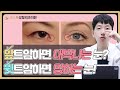 앞트임VS윗트임! 내 눈에 알맞는 트임수술은?! 장.단점과 차이점 알려드립니다!! [라스트성형외과]