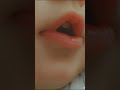 ألايد جكليته  والفم 