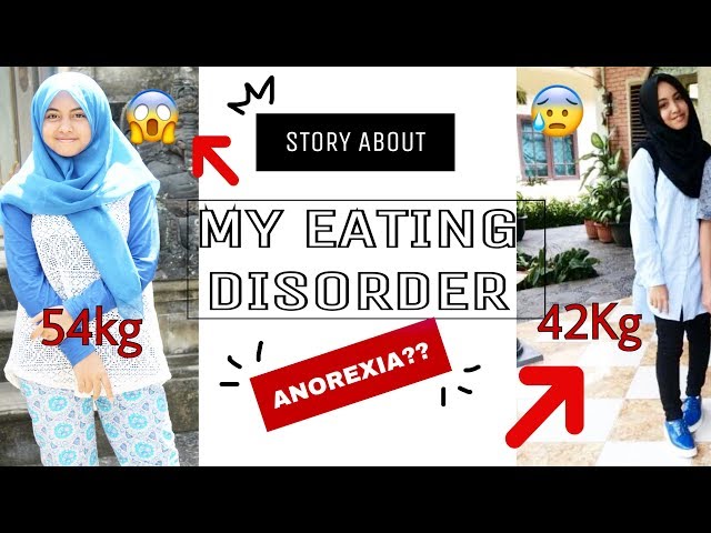 TURUN BERAT BADAN 12 KG DENGAN DIET KETAT? SAMPE ANOREXIA?! #MyDietStory #MyEatingDisorderStory 😓😱😰 class=