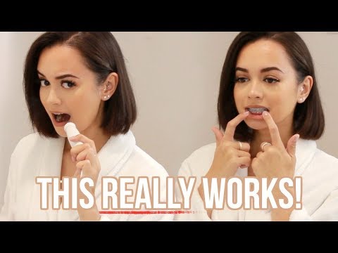 HOW TO KEEP YOUR TEETH WHITE & CLEAN WITH BRACES