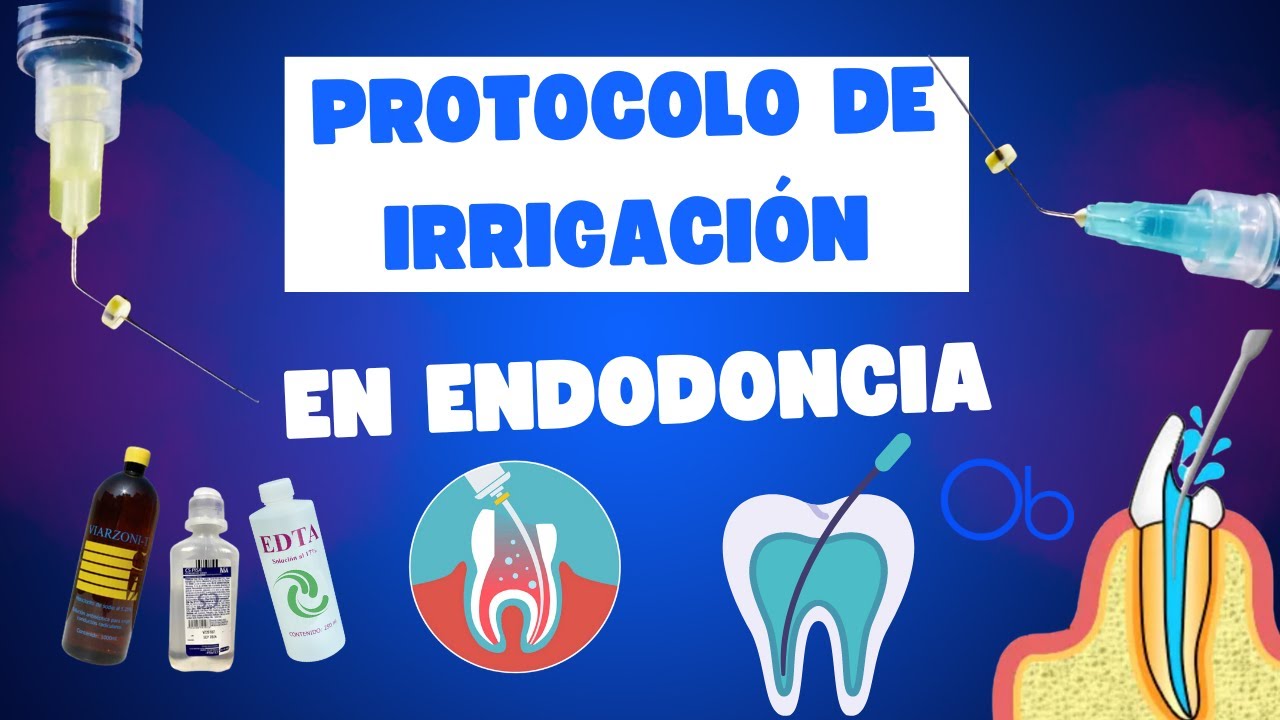 Protocolo de Irrigación en Endodoncia 🦷 💧 paso a paso