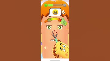 FUN GAME ASMR MEGA PIMPLE POPPING #71| SHORT SATISFYING VIDEO GAME | ANDROID/IOS