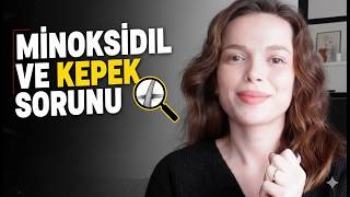 Minoksidil Ve Kepek Sorunu, Saç Bakımı Deneyimlerim