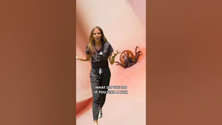 What to do if you find a TICK on you! #doctor #shorts #summertips #howto #tick #tickremoval