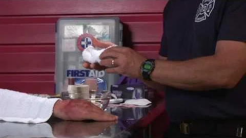 First Aid Tips : How to Treat a Burn in the Wilderness