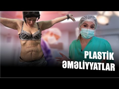 Video: Bir insanın gözü ilə plastik cərrahiyyə