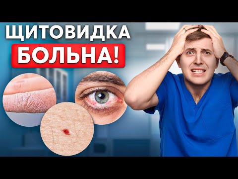 ЩИТОВИДКА БЬЕТ ТРЕВОГУ! Причины и признаки заболеваний щитовидки