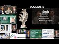 Adolescent idiopathic scoliosis  scoliosis research society annual meeting  w dr brandon carlson