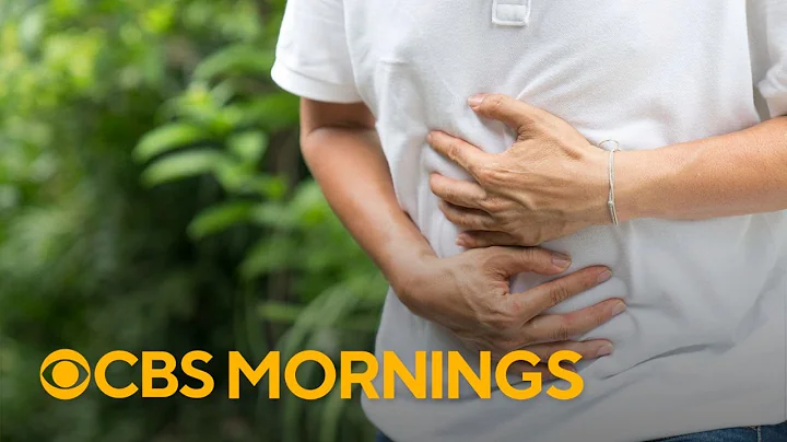 How to spot the symptoms of serious acid reflux