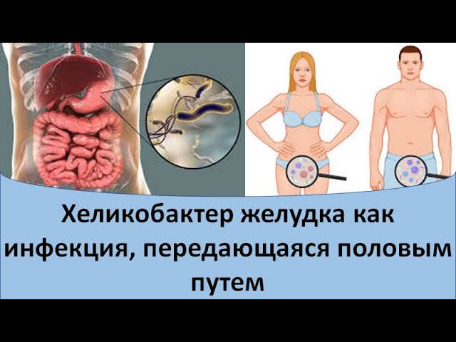 Хеликобактер как инфекция, передающаяся половым путем