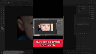 how to remove pimples in adobe photoshop ?reels graphicdesign editing adobephotoshop foryou