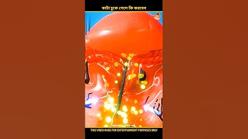 How Splinters Get Unstuck 😱 #shorts #ytshorts #facts