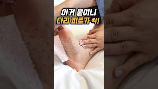 이거 붙였더니 내다리 왜이렇게 가벼워…?|227번
