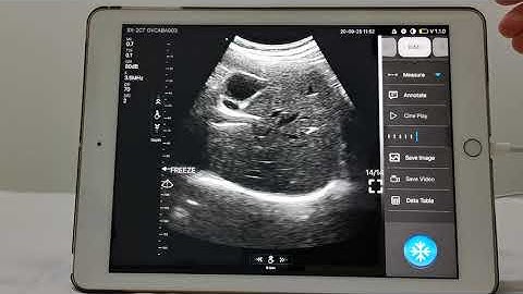 Double Probes Wireless Handheld Ultrasound Scanner-D5CE