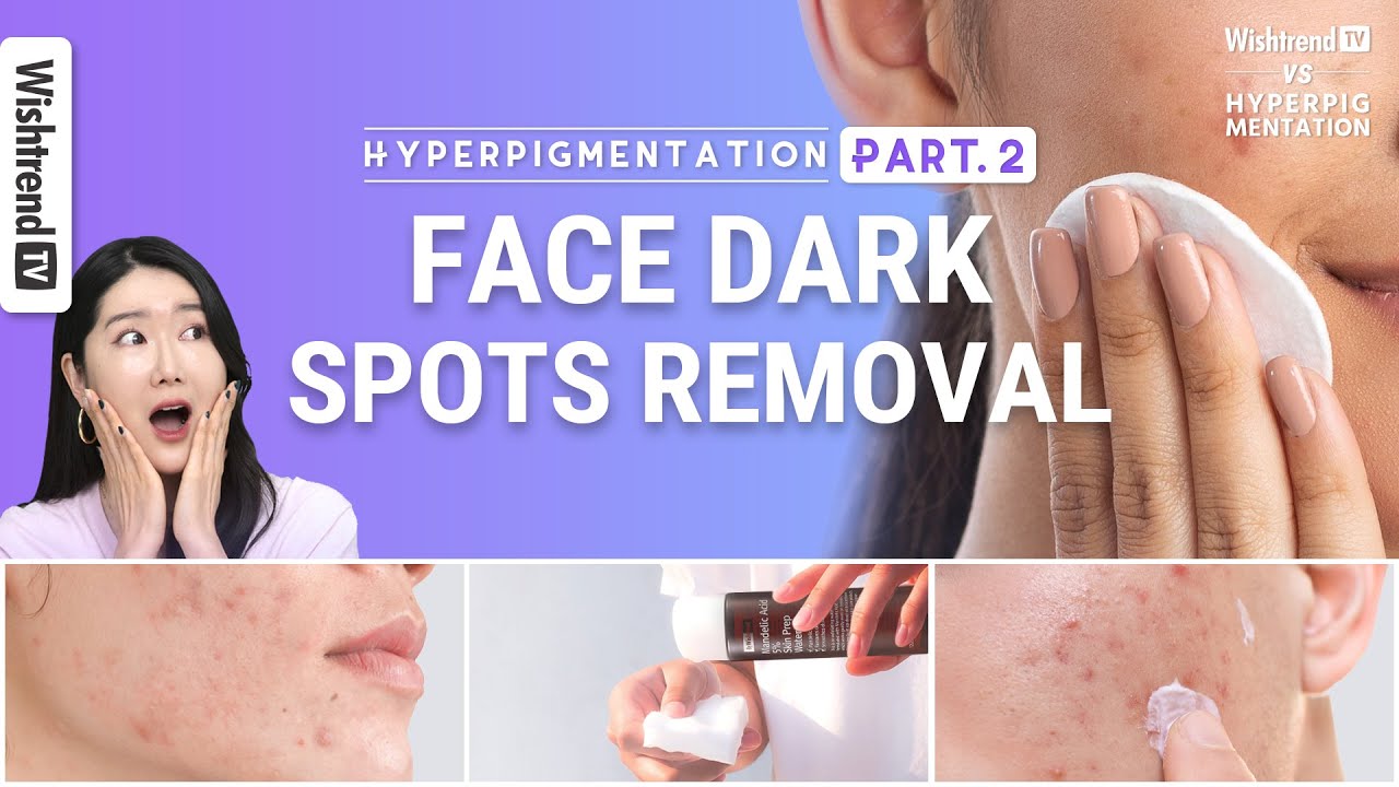 Hyperpigmentation Skincare Tips Brightening with AHA, BHA Fade Face