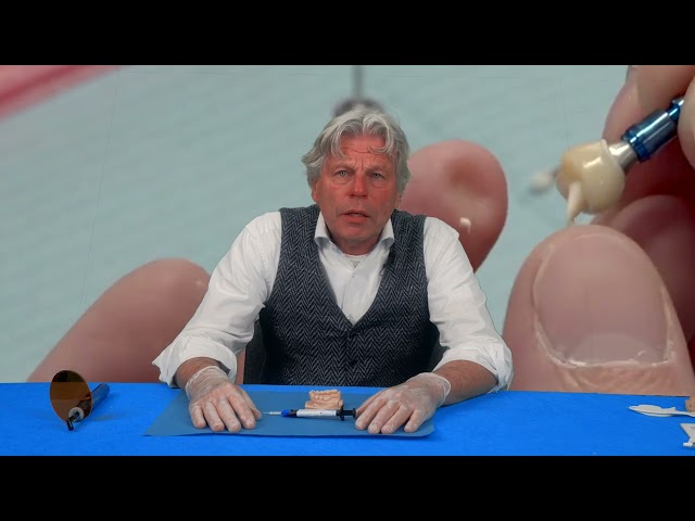 FAQ Visalys® CemCore door tandarts Rob Vermaas: Cementen op abutments uitsluitend door de tandarts?