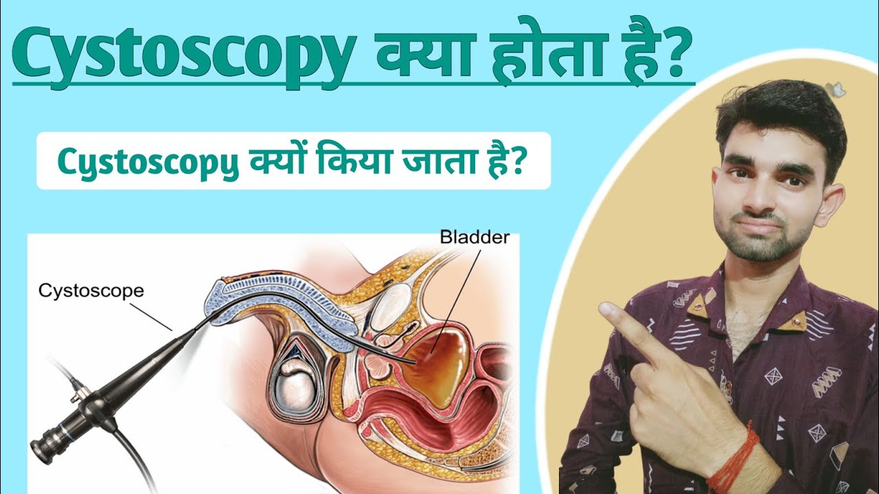 cystoscopy-in-hindi-cystoscopy-meaning-purpose-and-complications