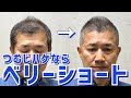 【薄毛】頭頂部ハゲを解決するヘアスタイル