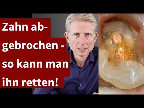 Video: Wie man einen gebrochenen Zahn behandelt (mit Bildern)