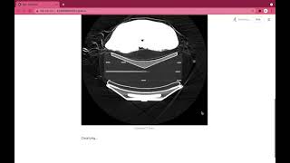 DIME APP - Breast Cancer CT Scan Classification using CNNs screenshot 2