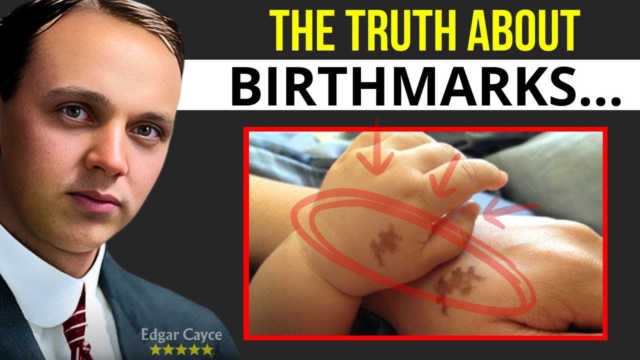 THE FORBIDDEN MYSTERY OF BIRTHMARKS AND PAST LIVES | EDGAR CAYCE EXPLAINS