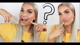 IS INVISALIGN WORTH IT? ... FINAL THOUGHTS! | Natalie Boucher