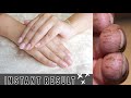 How to get rid of Cracked, Dry, Peeled fingers|| Overnight Healing Remedy Must try!