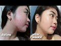 KOREAN GLASS SKIN ACHIEVED IN JUST 2 WEEKS! 😱 | Camille Romero